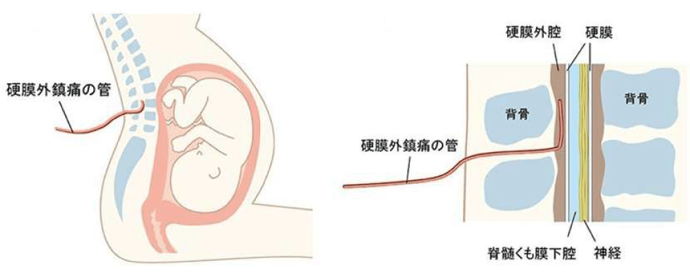 図：麻酔の方法